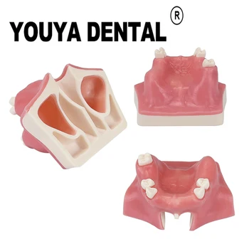  Implant Practica Model Sinusului Maxilar Dintele Model pentru Dentist Predare Elev Studiază Orală Medicale Stomatologie Instrumente